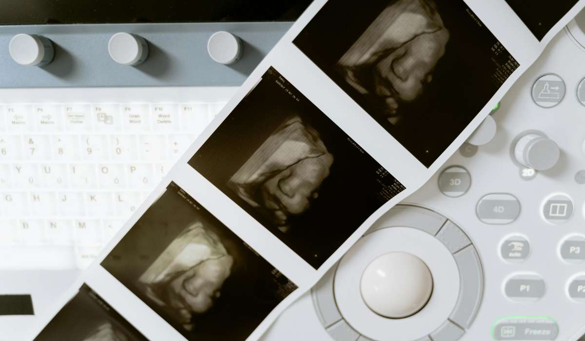 Detectar y Prevenir Enfermedades con una Revisión Ginecológica