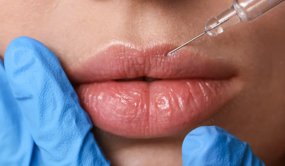 Hidratación de labios: Cómo tener unos labios jugosos sin aumentar de volumen